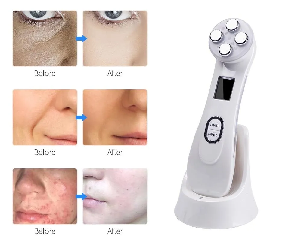 LED Photon Mesotherapy Electroporation RF Radio Frequency Face Lifting Wrinkle Reduction Massager